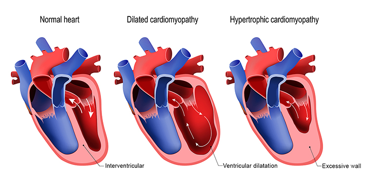 &Upsilon;&pi;&epsilon;&rho;&tau;&rho;&omicron;&phi;&iota;&kappa;ή &Mu;&upsilon;&omicron;&kappa;&alpha;&rho;&delta;&iota;&omicron;&pi;ά&theta;&epsilon;&iota;&alpha; - &Nu;&iota;&kappa;ό&lambda;&alpha;&omicron;&sigmaf; &Kappa;&alpha;&delta;ό&gamma;&lambda;&omicron;&upsilon; | Nikolaos Kadoglou