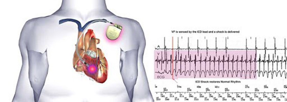 &Epsilon;&mu;&phi;ύ&tau;&epsilon;&upsilon;&sigma;&eta; &beta;&eta;&mu;&alpha;&tau;&omicron;&delta;&omicron;&tau;ώ&nu; &kappa;&alpha;&iota; &pi;&rho;&omicron;&eta;&gamma;&mu;έ&nu;&omega;&nu; &sigma;&upsilon;&sigma;&kappa;&epsilon;&upsilon;ώ&nu; (&alpha;&pi;&iota;&nu;&iota;&delta;&omega;&tau;ώ&nu; &kappa;&alpha;&iota; &alpha;&mu;&phi;&iota;&kappa;&omicron;&iota;&lambda;&iota;&alpha;&kappa;ώ&nu; &sigma;&upsilon;&sigma;&tau;&eta;&mu;ά&tau;&omega;&nu;)
