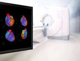 &Delta;&upsilon;&nu;&alpha;&mu;&iota;&kappa;ή &eta;&chi;&omega;&kappa;&alpha;&rho;&delta;&iota;&omicron;&gamma;&rho;&alpha;&phi;ί&alpha; (Stress Echo)